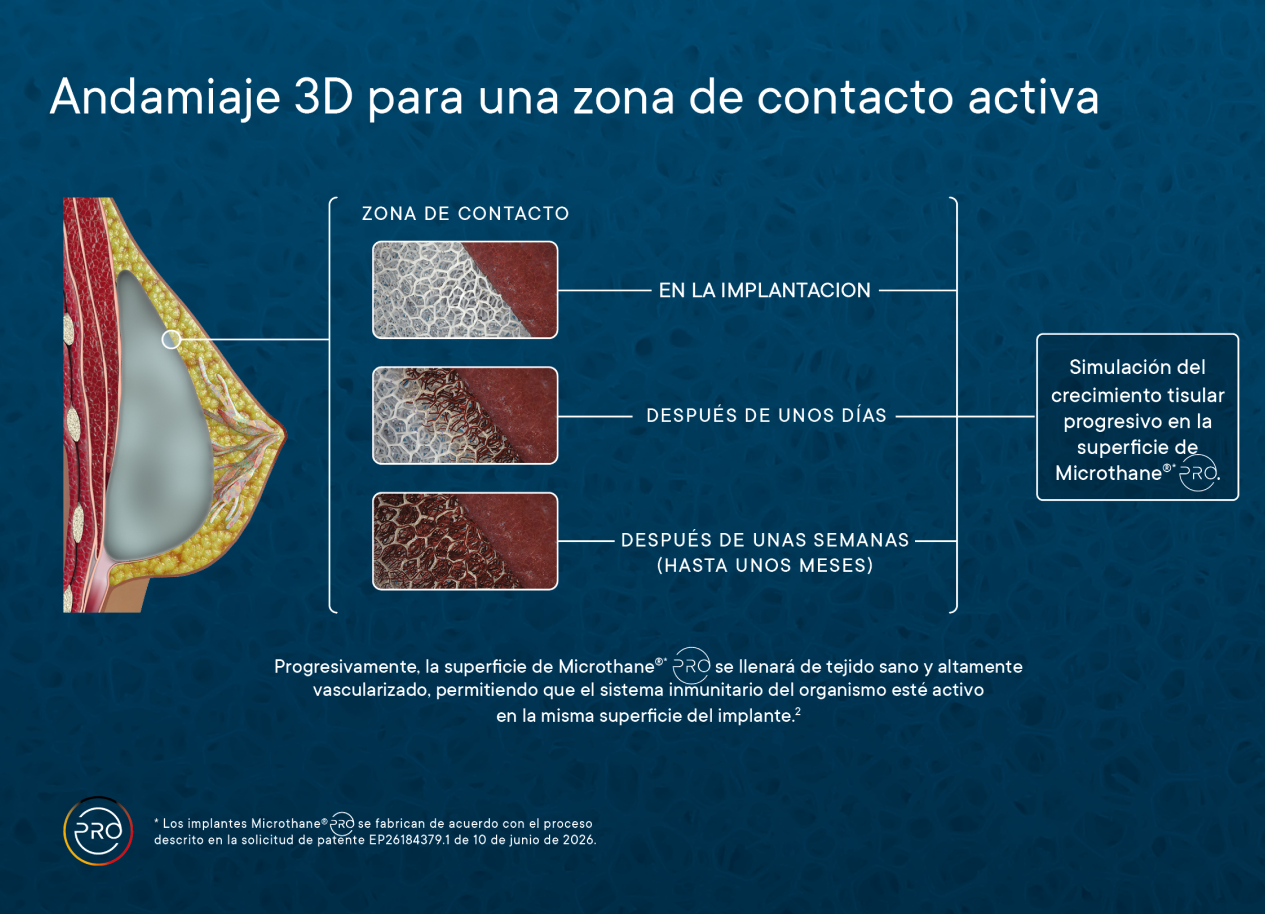 3D-Darstellung eines aktiven Kontaktbereichs mit verschiedenen Phasen der Gewebeintegration und Mikrothänge nach der Implantation.