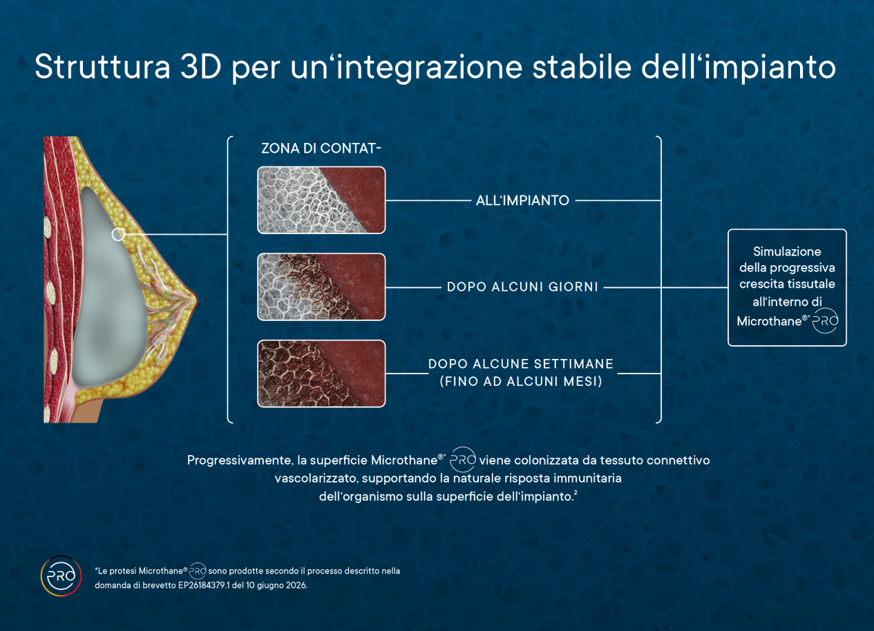 Struttura 3D che illustra l'integrazione stabile dell'impianto Microthane® con un focus su zona di contatto, modulo iniziale e crescita tissutale.